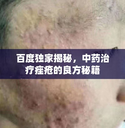 百度独家揭秘，中药治疗痤疮的良方秘籍